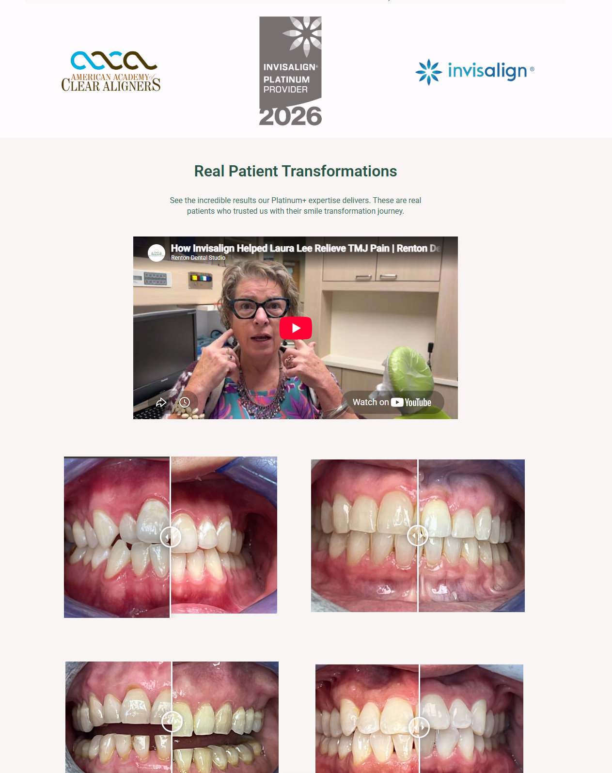 Real Patient Transformations section with Platinum Provider logos and before-and-after cases